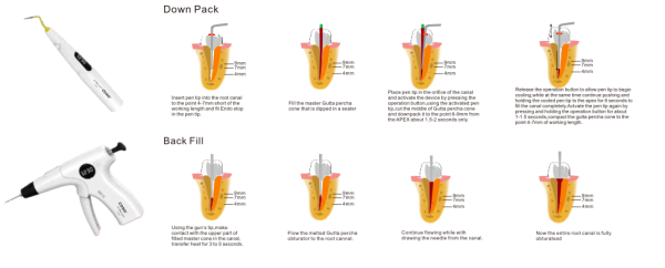 C-FILL MINI Endodontisk obturasjons system - Bilde 6